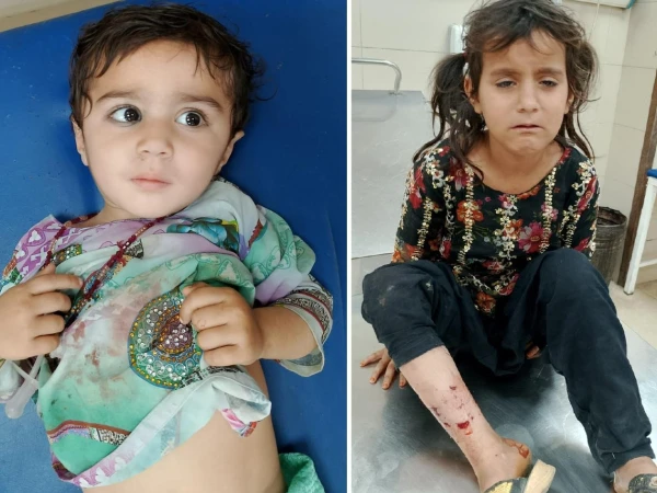 کراچی: آوارہ کتوں کے حملے میں 2 کمسن بہنیں زخمی کراچی: آوارہ کتوں کے حملے میں 2 کمسن بہنیں زخمی